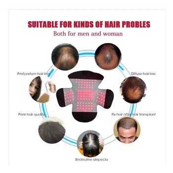 Laser Ravi Juuste Kasvu Kiiver 80 Meditsiini Dioodid Anti Hair Loss Edendada Juuksed Regrowth Laser Ühise Põllumajanduspoliitika Massaaž Seadmed - Pilt 2  